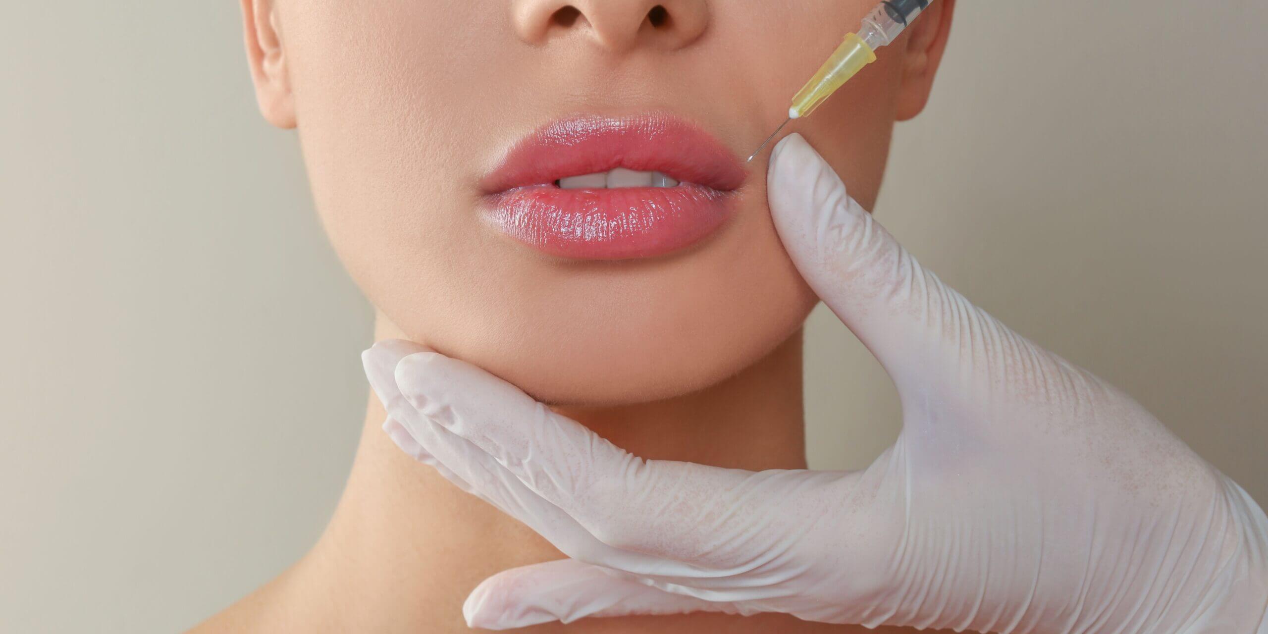Combining-Lip-Fillers-with-a-Laser-Lip-Lightening-Treatment